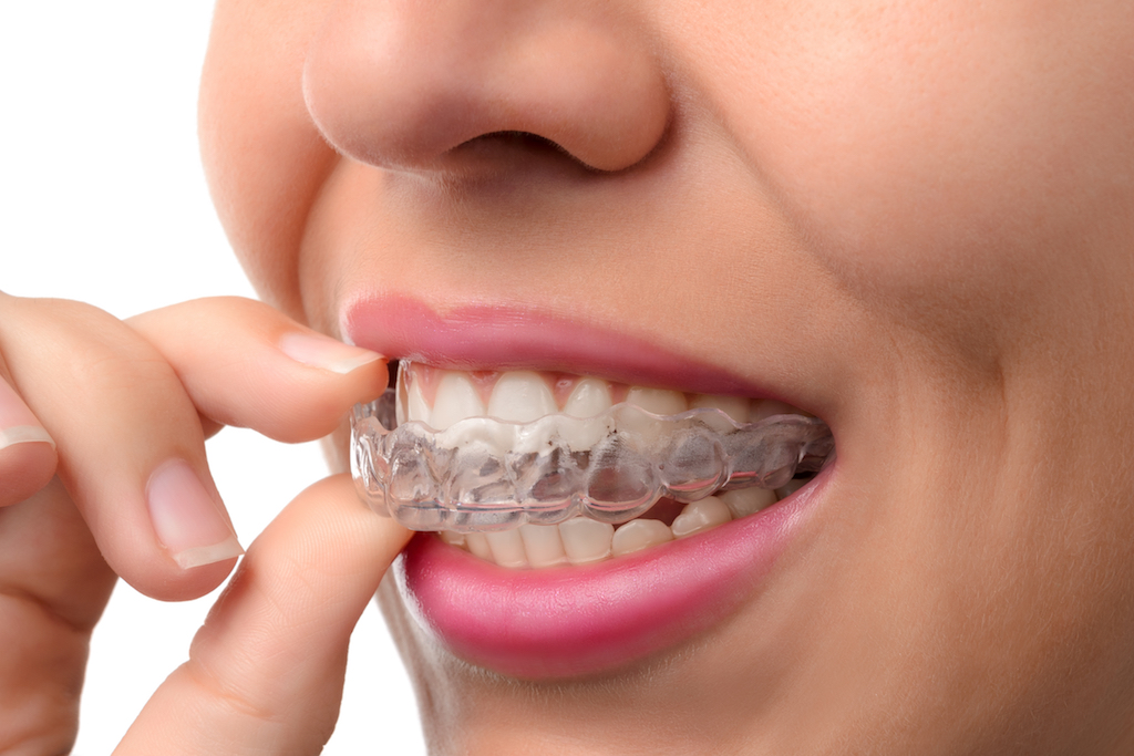 Invisalign Flourtown, Chestnut Hill & Philadelphia Dental Braces